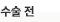 수술전