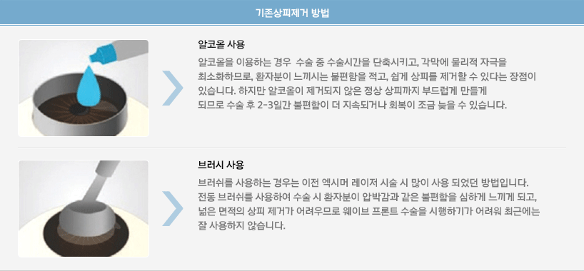 - 알코올 사용 알코올을 이용하는 경우  수술 중 수술시간을 단축시키고, 각막에 물리적 자극을 최소화하므로, 환자분이 느끼시는 불편함을 적고, 쉽게 상피를 제거할 수 있다는 장점이 있습니다. 하지만 알코올이 제거되지 않은 정상 상피까지 부드럽게 만들게 되므로 수술 후 2-3일간 불편함이 더 지속되거나 회복이 조금 늦을 수 있습니다. - 브러시 사용 브러쉬를 사용하는 경우는 이전 엑시머 레이저 시술 시 많이 사용 되었던 방법입니다. 전동 브러쉬를 사용하여 수술 시 환자분이 압박감과 같은 불편함을 심하게 느끼게 되고, 넒은 면적의 상피 제거가 어려우므로 웨이브 프론트 수술을 시행하기가 어려워 최근에는 잘 사용하지 않습니다.