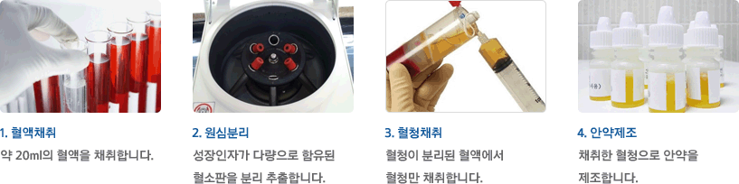  자가혈청 안약 제조 과정 1. 혈액채취 2. 원심분리 3. 혈청채취 4. 안약제조